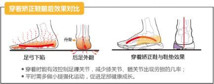 爱矫健护足课堂 扁平足要注意科学选鞋